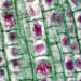 Photomicroscopy