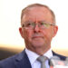 Albanese “Crossed the Line”: Ley Slams UK Speech
